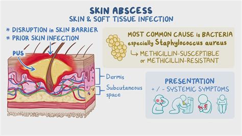 abscess antonyms|abscess synonym medical.